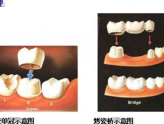 口腔治疗中的骗局都有哪些？这些坑不要踩！