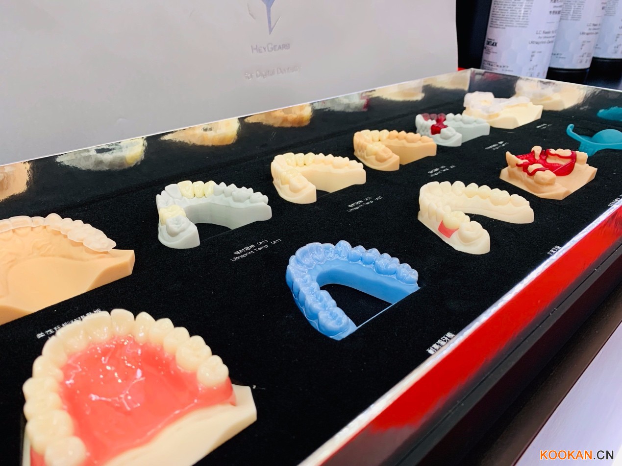 3D打印技术在口腔修复体直接制作中的应用