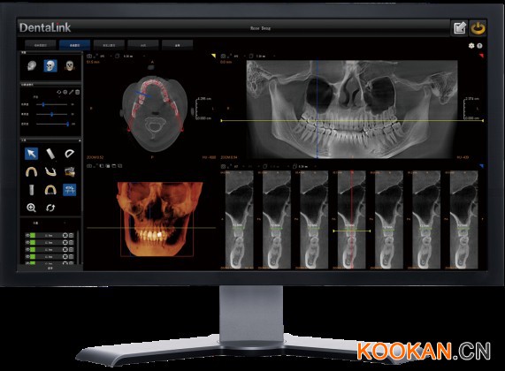 菲森CBCT专业影像诊断软件