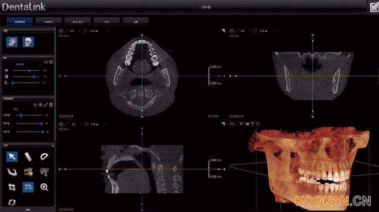 牙医管家CBCT软件界面