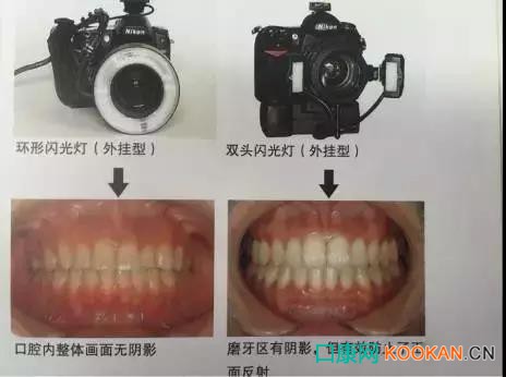 拍不好口腔照片怎么办？这些口腔摄影方法与技巧请收好！