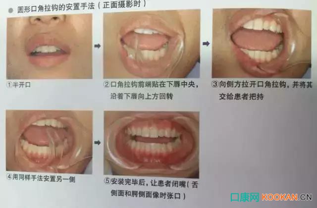 拍不好口腔照片怎么办？这些口腔摄影方法与技巧请收好！