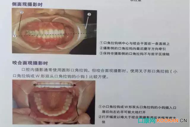 拍不好口腔照片怎么办？这些口腔摄影方法与技巧请收好！