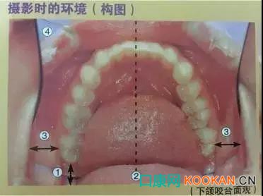 拍不好口腔照片怎么办？这些口腔摄影方法与技巧请收好！