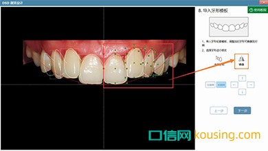 DSD美学设计口腔管理软件镜像工具实现高效化调整