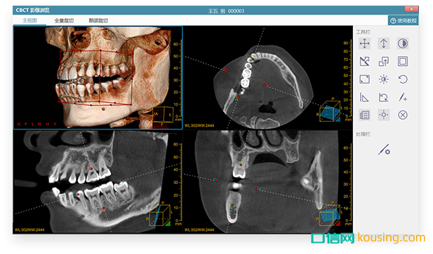 牙医管家软件支持医学标准DICOM接口