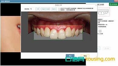 DSD美学微笑设计口腔管理软件工具多样调试