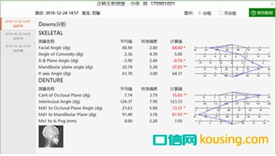 重叠分析