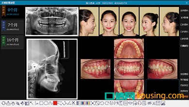 牙医管家标准版